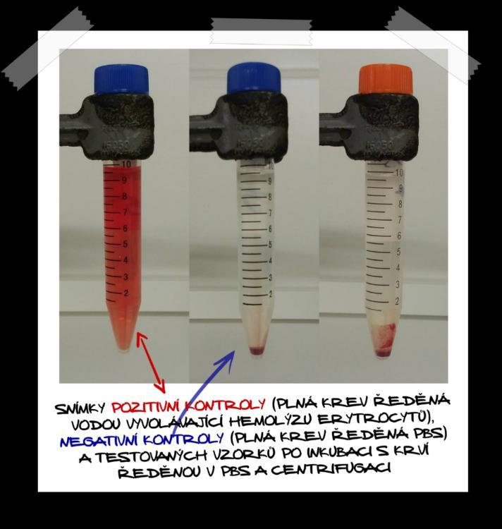 VÝSLEDKY I TEST HEMOLÝZY INKUBACE VLÁKENNÝCH MATERIÁLŮ SE ZŘEDĚNOU PLNOU KRVÍ POSITIVNÍ KONTROLA: PLNÁ KREV ŘEDĚNÁ