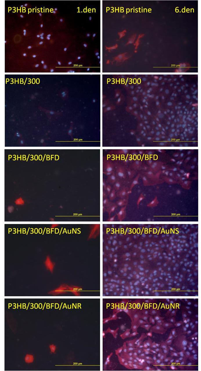 Chem. Listy 111, 223 228 (2017) na skupiny13 (radikál, dvojnou vazbu, karbonylovou, karboxylovou popř. esterovou skupinu), které vznikly při modifikaci povrchu polymeru v plazmatu.