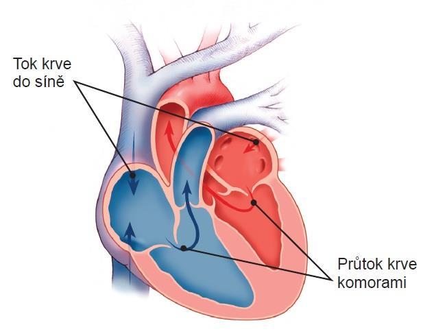Příloha č. 2 Srdce a krevní toky v něm Zdroj: BOSTON SCIENTIFIC.