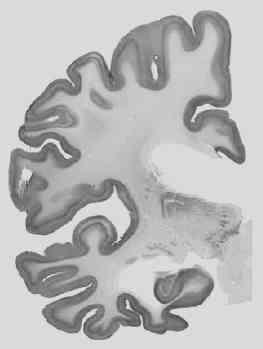 , Acta Neuropathol