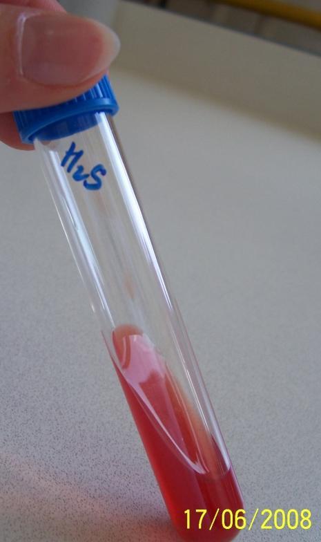 Obrázek 2 Tvorba sirovodíku Foto: Věra Kaválková 6.2 Ostatní testy 6.2.1 Cytochromoxidázový test Průkazem aktivity cytochromoxidázy (oxidázy) rozlišíme enterobakterie od pseudomonád, aeromonád či plesiomonád.