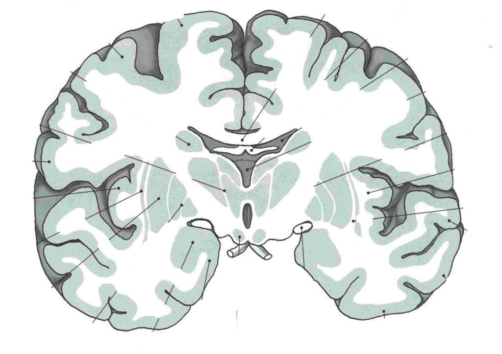 Frontální řez mozkem Nucleus caudatus Claustrum Corpus callosum ventriculus