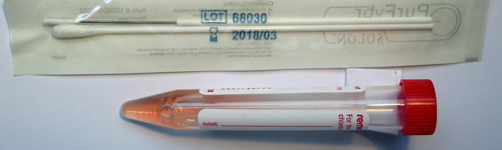 Ostatní materiály a lokalizace odběry pro průkaz DNA Chlamydia trachomatis a DNA Chlamydia pneumoniae metodou PCR odběry pro průkaz adenovirů odběry na bakteriologické vyšetření spojivkové stěry