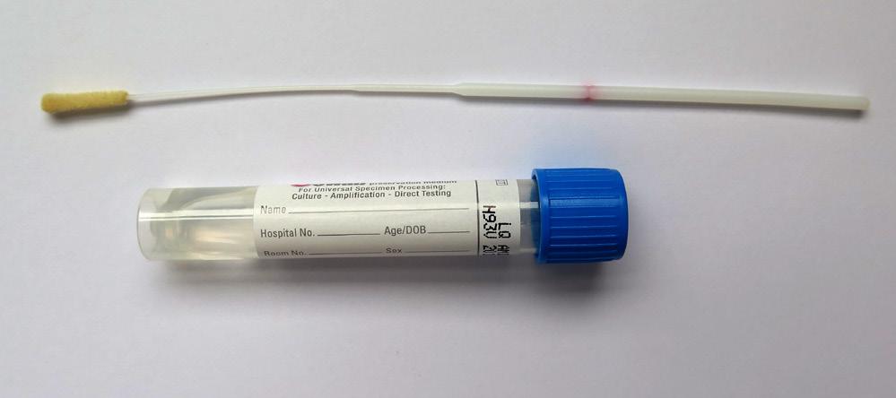 Horní cesty dýchací (HCD) průkaz DNA Bordetella pertussis/parapertussis, RNA viru chřipky A a B, DNA Chlamydia pneumoniae, DNA Mycoplasma pneumoniae (metodou PCR) nasopharyngeální výtěr obecné