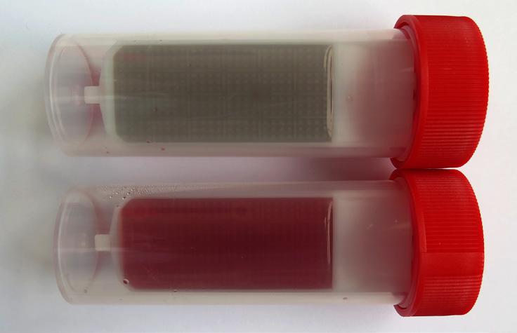 Urogenitální trakt bakteriologická kultivace průkaz antigenů Streptococcus pneumoniae (SP) a Legionella pneumophila (LP) moč 10 15 ml středního proudu moče (před odběrem je nutná důkladná hygiena