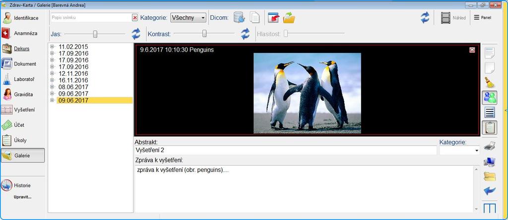 galerii: