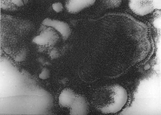 Virus