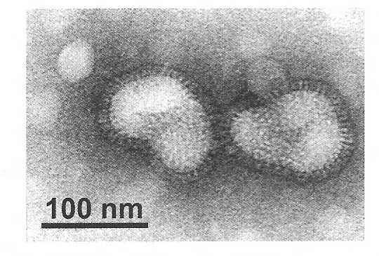 Virus