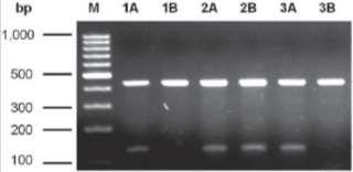 DNA (PCR)