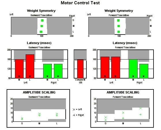 2. Motor Control Test (MCT) Obrázek 78 - vstupní Motor Control Test Vyhodnocení vstupního MCT Weight Symmetry Backward Translations (symetrie zatížení dolních končetin při pohybech plošiny vzad) obr.