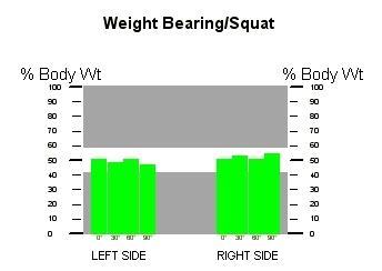 výstupního (vpravo) hodnocení Weight Bearing/ Squat (obr.