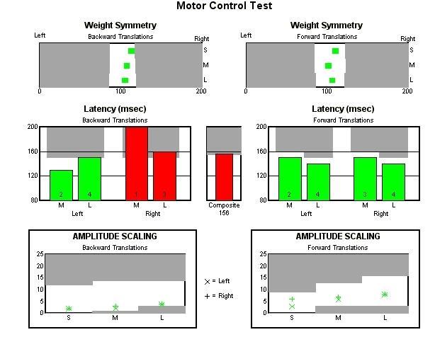 2. Motor Control Test (MCT) Obrázek 2 - vstupní Motor Control Test Vyhodnocení vstupního MCT Weight Symmetry Backward Translations (symetrie zatížení dolních končetin při pohybech plošiny vzad) obr.