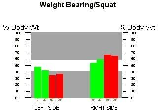 4.7.4 Porovnání výsledků WBS před a po terapii Obrázek 30 - porovnání rozložení hmotnosti ve vzpřímeném stoji a v podřepech 30, 60 a 90 u vstupního (vlevo) a výstupního (vpravo) hodnocení Weight