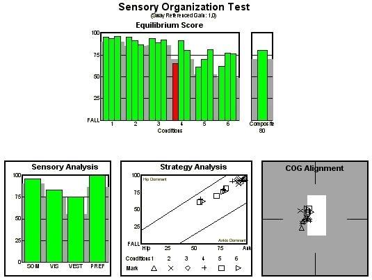 1. Sensory Organization Test (SOT) Obrázek 39 - vstupní Sensory Organization Test Vyhodnocení vstupního SOT Equilibrium Score (procentuální vyjádření stability) obr.