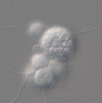 Nové biotechnologické zdroje DHA Schizochytrium spp.