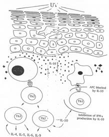 UV-B = Karcinogen = Imunosupresant Lokální imunosuprese - selektivní aktivace CD8 (Ts) - pokles Langerhansových bb.