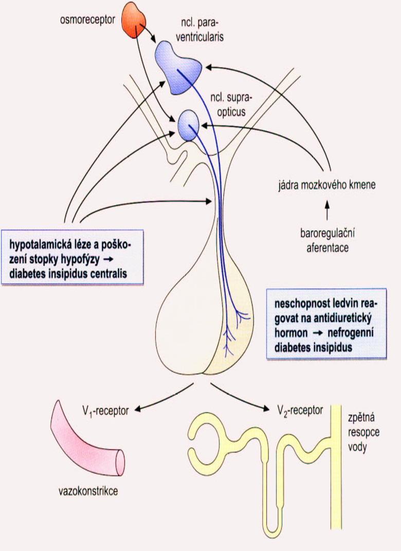 Renální diabetes insipidus - defekt genu pro V 2 receptor ( X chromozom) nebo mutace genu pro vodní kanál akvaporin 2 v epiteliích