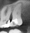 CBCT 28