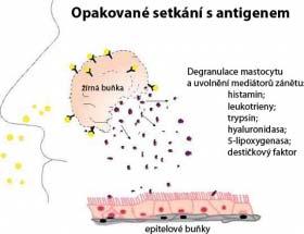 Efektorová fáze alergické reakce Setká-li se senzibilizovaná buňka opakovaně s odpovídajícím alergenem, dojde k vazbě alergenu s IgE na povrchu žírné buňky (obr.