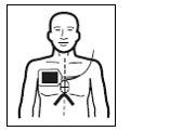 Aplikace defibrilačních elektrod pro dospělé CPR Stat-padz Aplikace defibrilačních elektrod VÝSTRAHA!