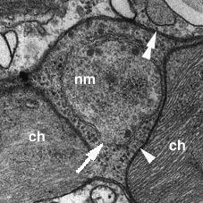 Sekundární endosymbióza - Přesídlení většiny genů z endosymbionta do eukaryotického jádra během primární endosymbiózy (plastidy kódují ne více než 200 proteinů, více než 1000
