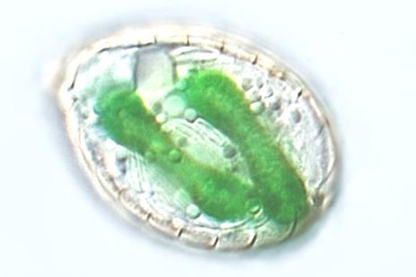 Recentní endosymbiózy Paulinella chromatophora, endosymbiont podobný sinicím