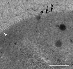 Tři vývojové linie primárních plastidů - Glaucophyta - jednoduchý fotosyntetizující plastid obalený peptidoglykanovou