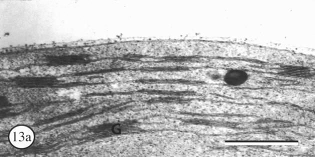 Chloroplasty ozářených a zastíněných listů Chloroplasty mají adaptační mechanismy umožňující přizpůsobit svou strukturu a funkci