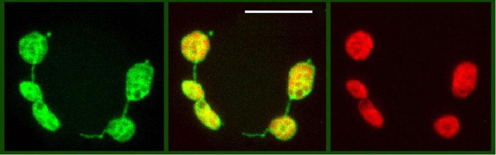 Stromuly - Stromuly (stroma-filled tubules) popsány především díky GFP technologii - Dynamické výrůstky plastidové membrány propojující plastidy a umožňující výměnu stroma mezi plastidy.