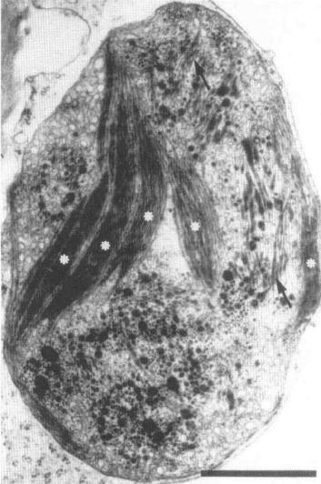 Chromoplasty - Obsahují: Kapénky lipidů/karotenoidů Fibrily (velké supramolekulové útvary, zásobárny karotenoidů).