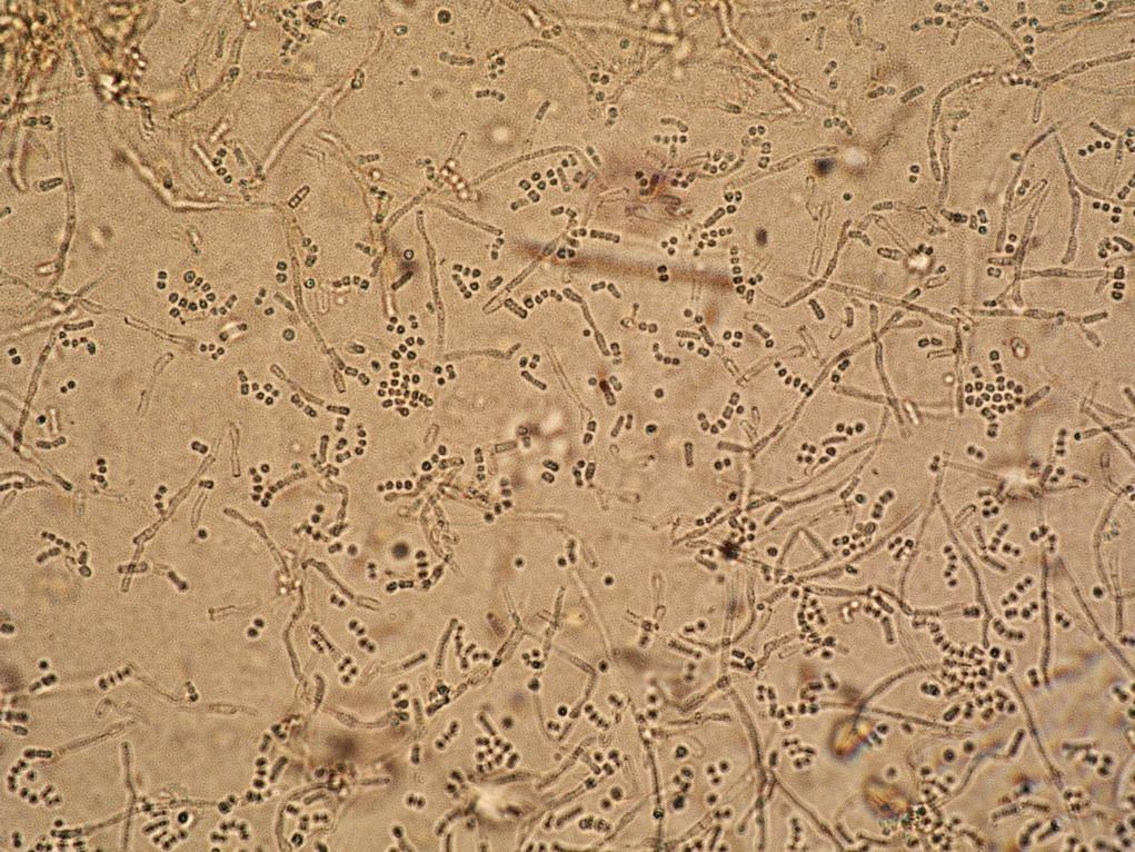 xerofilní mikromycet -Tvorba malých
