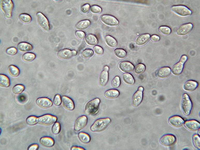 Oddělení: Chytridiomycota Microsporidiomycota Glomeromycota Zygomycota Ascomycota Basidiomycota Saccharomycodes ludwigii KVASINKY Yarrowia