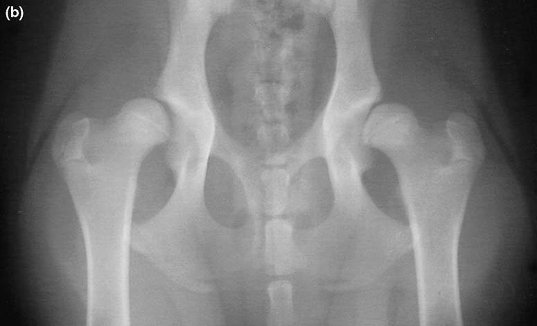 Nastávající změny zřejmě korelují s mírou a délkou doby biomechanické nerovnováhy.