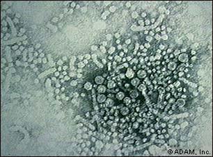 Virus hepatitidy B: 1) 20 nm kulovité částice HBsAg 2) 20 nm
