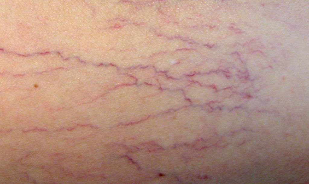 typu v ordinaci VPL v ČR a problematika glykovaného hemoglobinu v roce 2012 EXTERNÍ HODNOCENÍ KVALITY v roce 2013 ODBORNÉ ČLÁNKY Antiagregační terapie