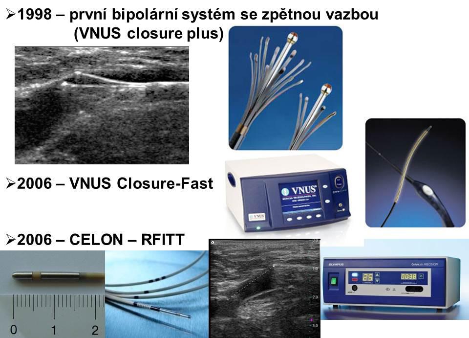 o d b o r n ý č l á n e k od osmdesátých let. Své uplatnění našla v kardiologii, neurologii, ORL, onkologii. Ve flebologii v Evropě byla prvně použita v roce 1998, v USA v roce 1999.