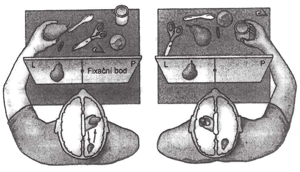 Teorie lidské psychiky 113 Na daném obrázku je problém rozděleného mozku (split-brain) prezentován jako koordinace mezi okem a rukou.