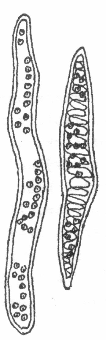 2. TRACHEIDY (CÉVICE) přechodné