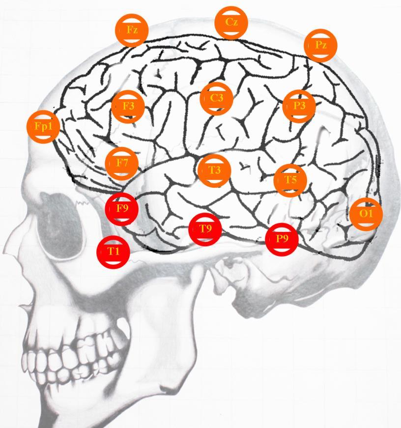 Vztah elektrod k anatomickým strukturám