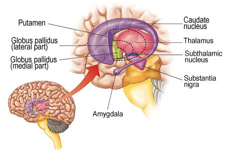 HLUBOKÁ MOZKOVÁ STIMULACE (deep brain stimulation DBS) nejčastější indikace