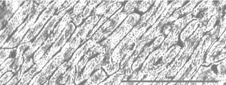 Plexiformní kostní tkáň nazývána také fibrolamelózní kostní tkáň jedná se o primární