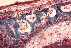 Buňky kostní tkáně Bone-linig cells (kost lemující buňky) vyvíjejí se z