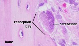 Buňky kostní tkáně Osteoklasty mnohojaderné buňky (15-20 jader) >40 µm.