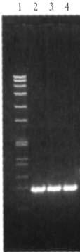 DETEKCE AMPLIFIKOVANÉHO PRODUKTU PCR DETEKCE AMPLIFIKOVANÉHO PRODUKTU PCR 1. Stanovení fyzikáln lní velikosti produktu gelovou elektroforézou (agar( agaróza, polyakrylamid).