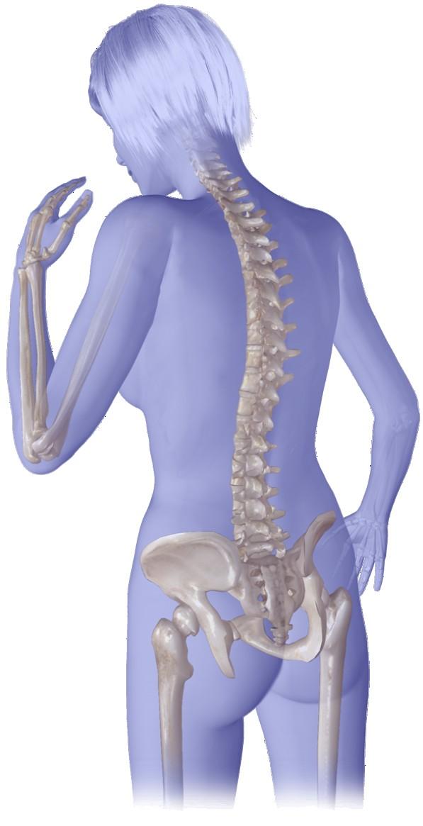 Kaskáda zlomenin u osteoporotické kosti Zlomenina zápěstí 2-násobné riziko 1 Obratlová zlomenina 5-násobné riziko 2 Zlomenina krčku 2-násobné riziko 3 Exitus 1.