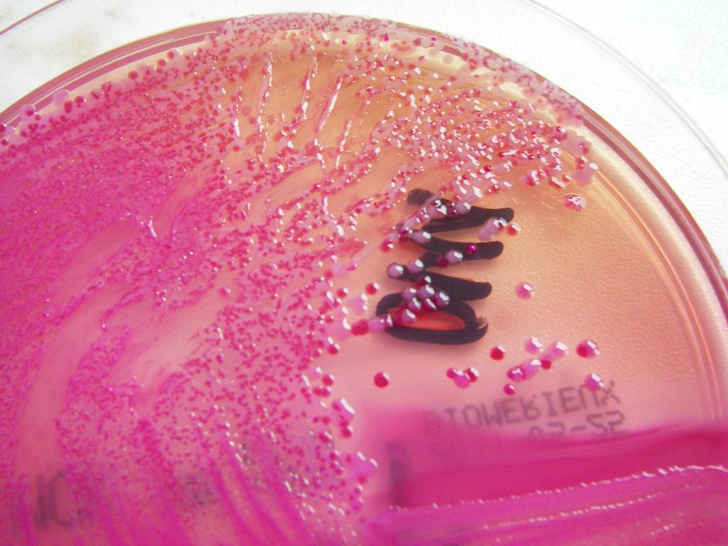 Obr. 19 Escherichia coli na MCK agaru Zdroj: