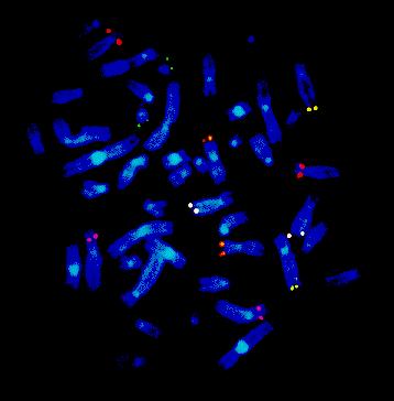 FISH (Fluorescenční in situ hybridizace) Moderní dg. metoda umožňující detekci poruch chromosomů a genů (patologických) na in situ chromosomech (např. jedné blastomery při asistované reprodukci).