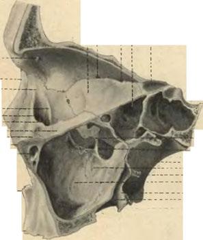 Hiatus maxillaris. Vomer. Processus maxillaris. conchae. Concha nasalis inf.
