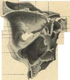 - «Crista conchalis ossis palatini. Lamina externa processus pterygoidei.