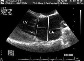 echocardiographic methods of assessing